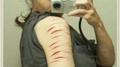 صورة إيذاء النفس “Self Harm”فأبناؤنا وبناتنا في خطر شديد