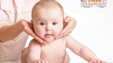 صورة الأجل الرقبي الولادي ” congential torticollis”