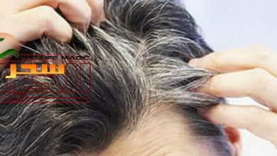 صورة  شيب الشعر المبكر  السبب والعلاج وطرق الوقاية