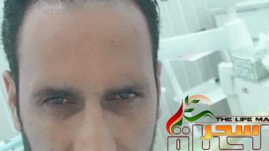 صورة “الدكتور عدنان عبد الرحيم “زراعة الأسنان تعتبر من أفضل التعويضات عن فقد الأسنان