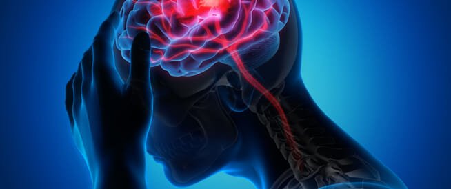 كيف تنجو من السكتات الدماغية المفاجئة؟