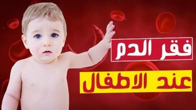 صورة فقر الدم عند الأطفال “الأسباب ..الأعراض..العلاج وطرق الوقاية”