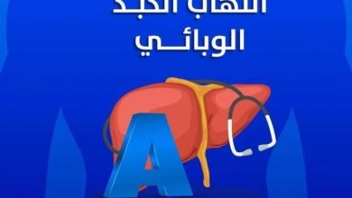 صورة التهاب الكبد A ..أعراضه وأهم الفحوصات عند الشك به