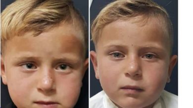 صورة د. أمية جنود ” ماهي جراحة تصحيح الحول للاطفال وما هدف علاجها ؟؟