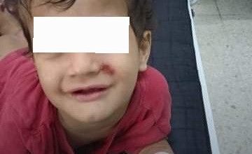 صورة أم تخلع أسنان طفلها وتدعو من قلبها أن يتألم ابنها